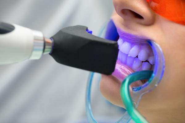 Teeth Whitening Bolton