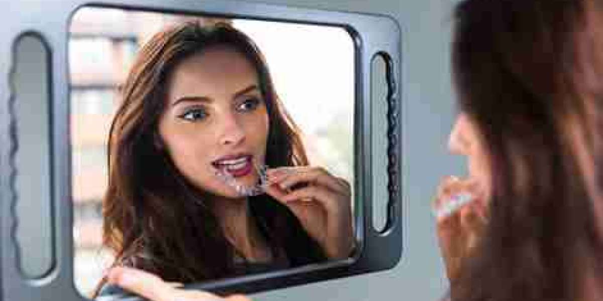 Invisalign-Induced Bruxism and Gentle Tooth Throbbing