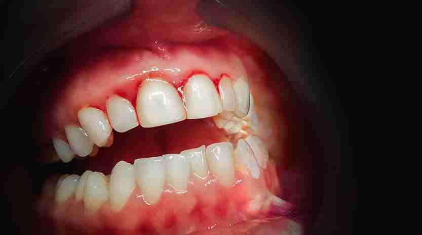 emergency dentist in Preston
