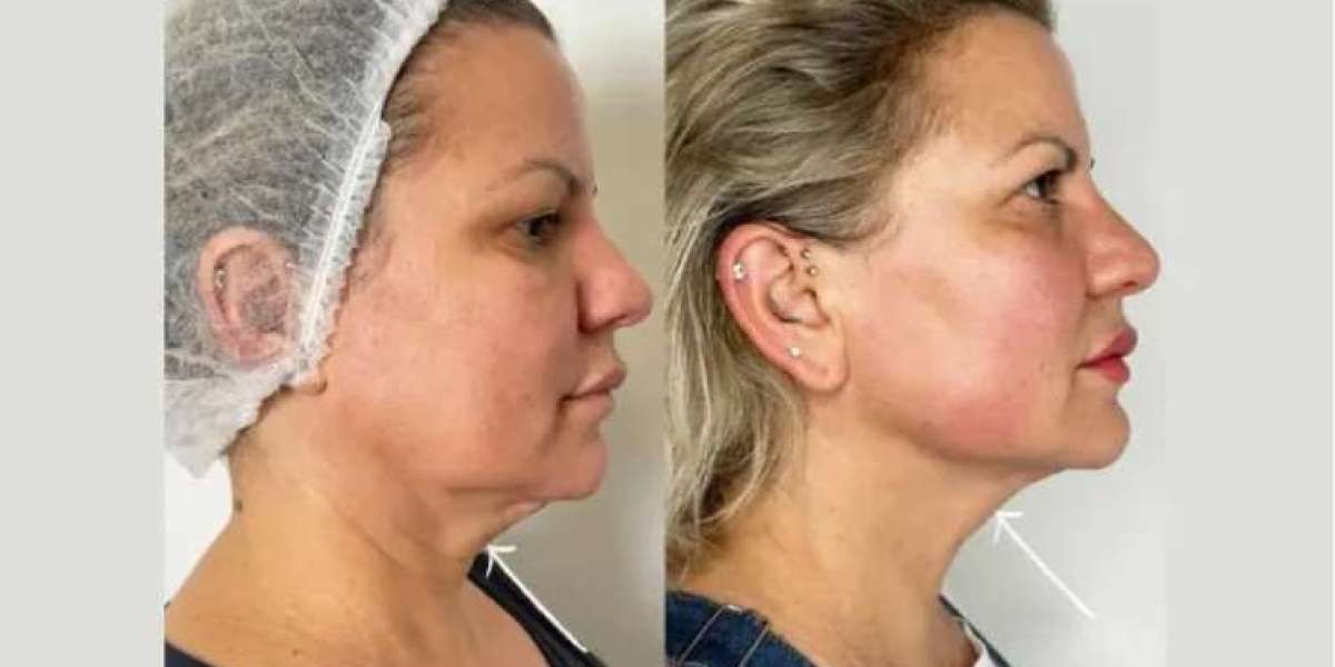 Why the Best Plastic Surgeon in Dubai Is in High Demand