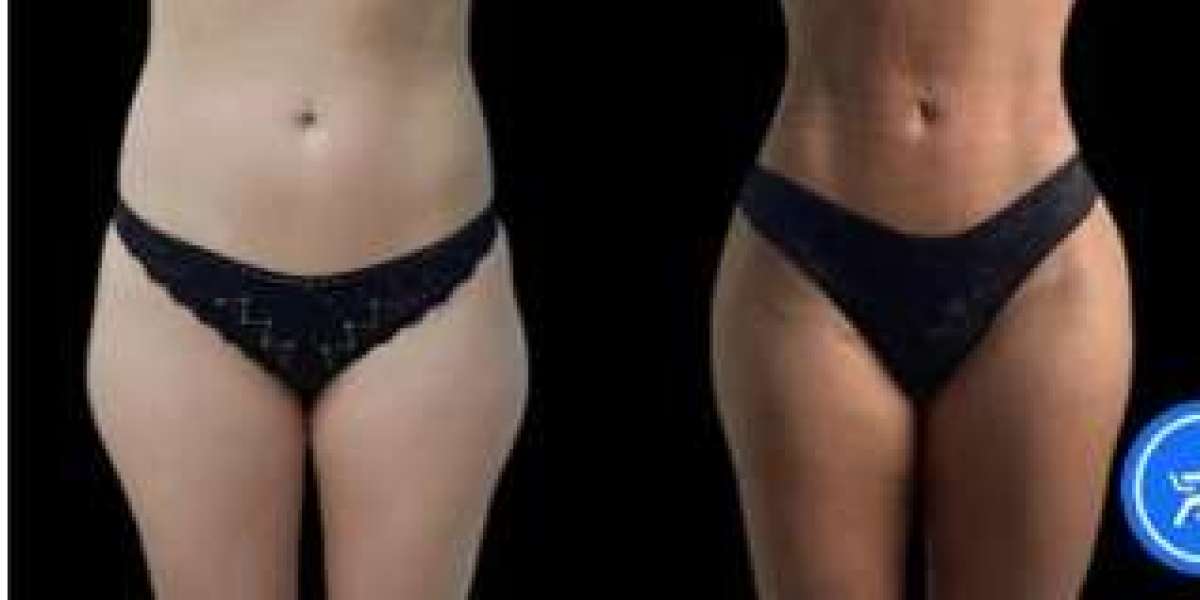 The Journey to Beauty with the Best Plastic Surgeon in Dubai
