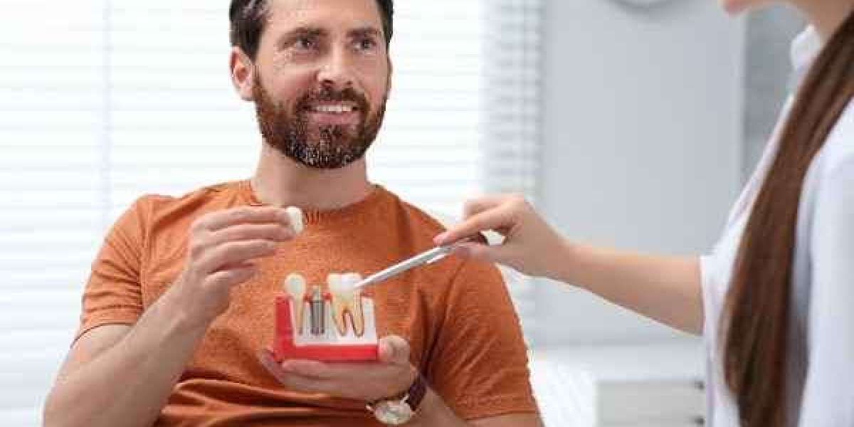 Common Questions About Dental Implants Answered in Fulham