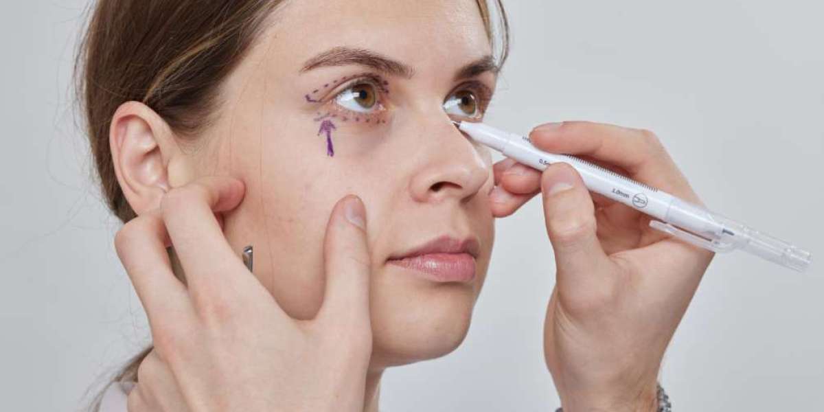 What Makes Polynucleotides Under Eyes So Popular in Manchester